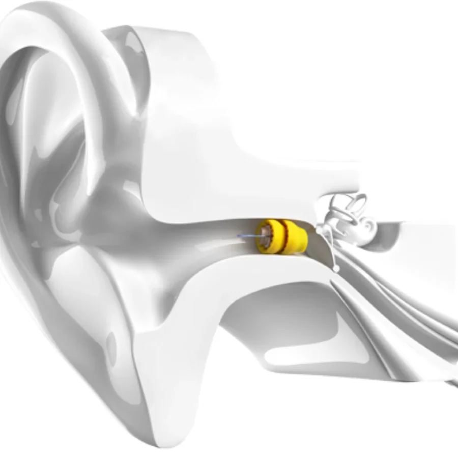 Phonak Lyric